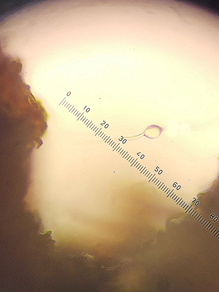 Maduracion oospora campaña 2022 Maduracion oospora campaña 2022