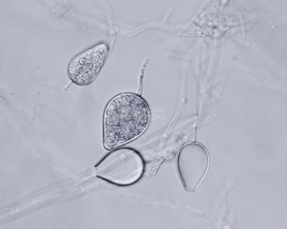 Esporangios caducos de Phytophthora ilicis